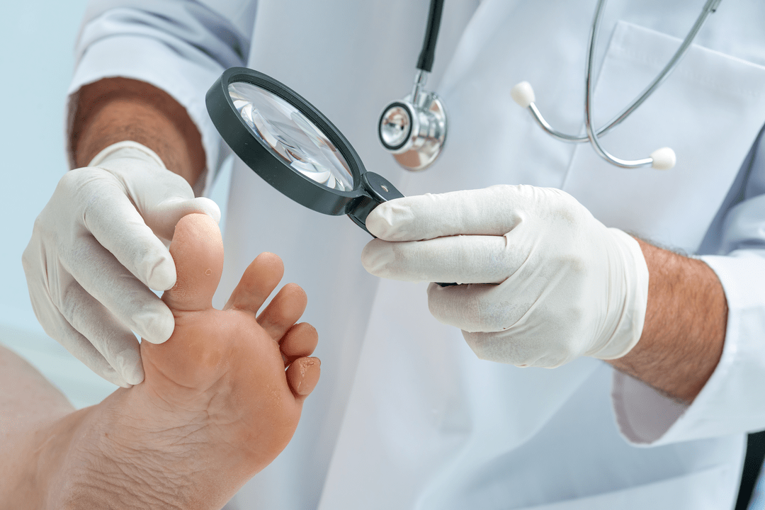 toenail fungus diagnosis