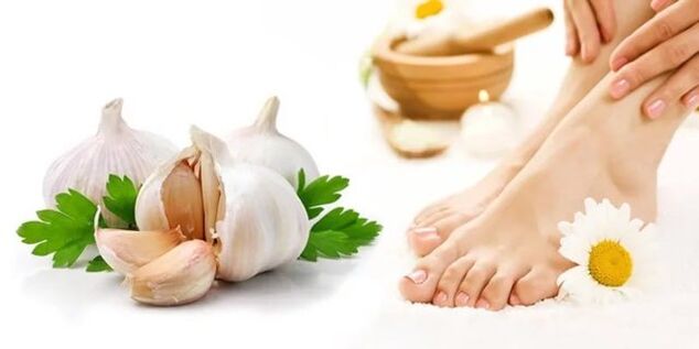 Garlic for preparing antifungal ointments and tinctures