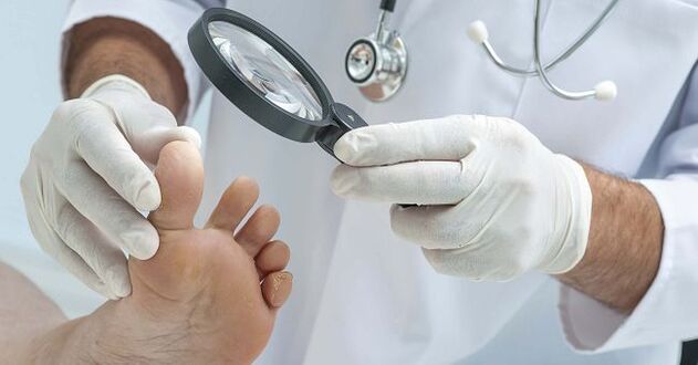 The doctor will prescribe a remedy for toenail fungus after diagnosing the disease